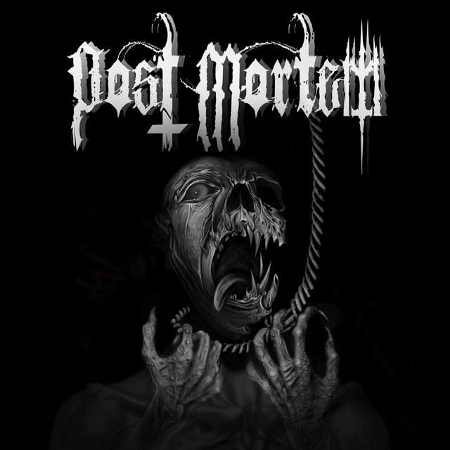 Post Mortem | Spotify