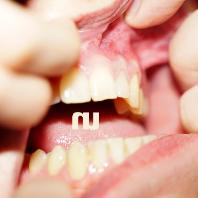 Bite My Tongue cover