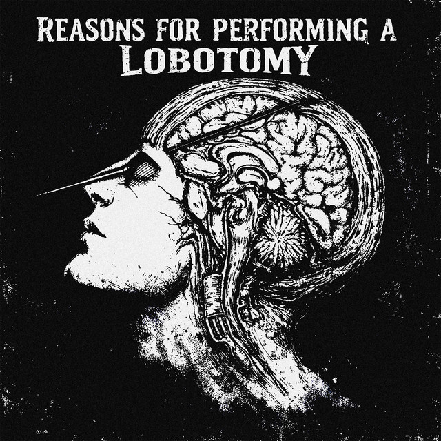 reasons for performing a lobotomy