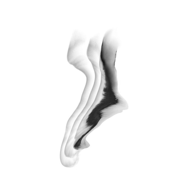 Redux cover art
