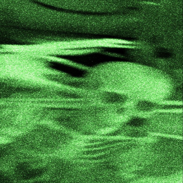 everything cover art