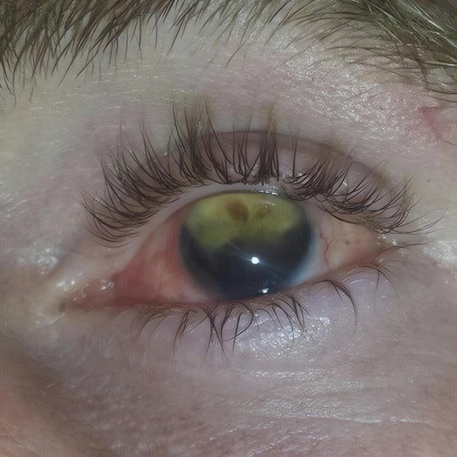 when your eyes turn red