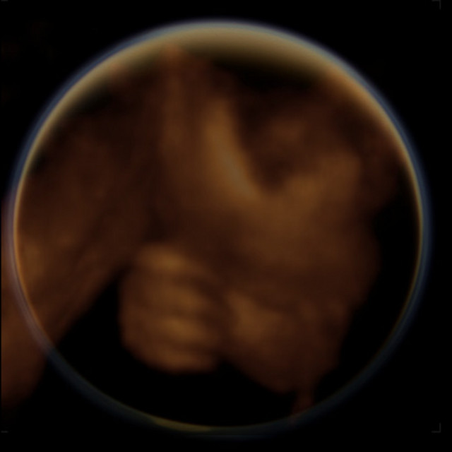 Sam I Am cover art