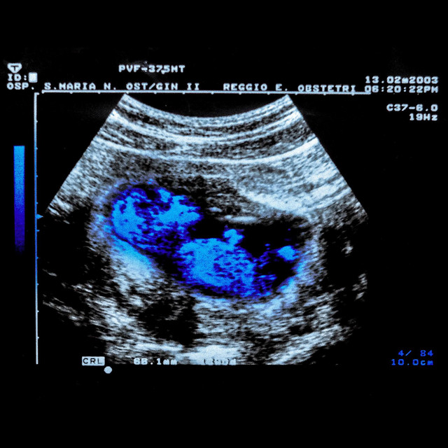 Mister Blu cover art