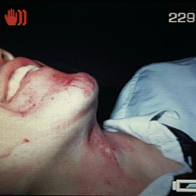 Scars cover art