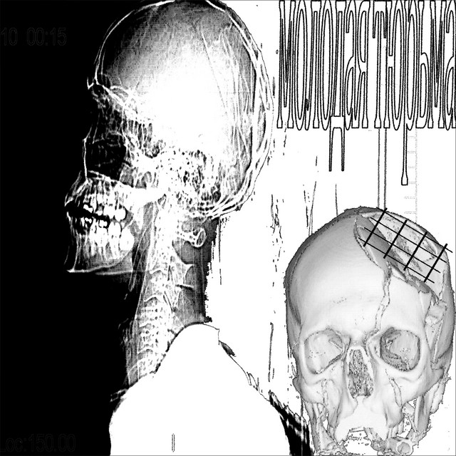молодая тюрьма cover art