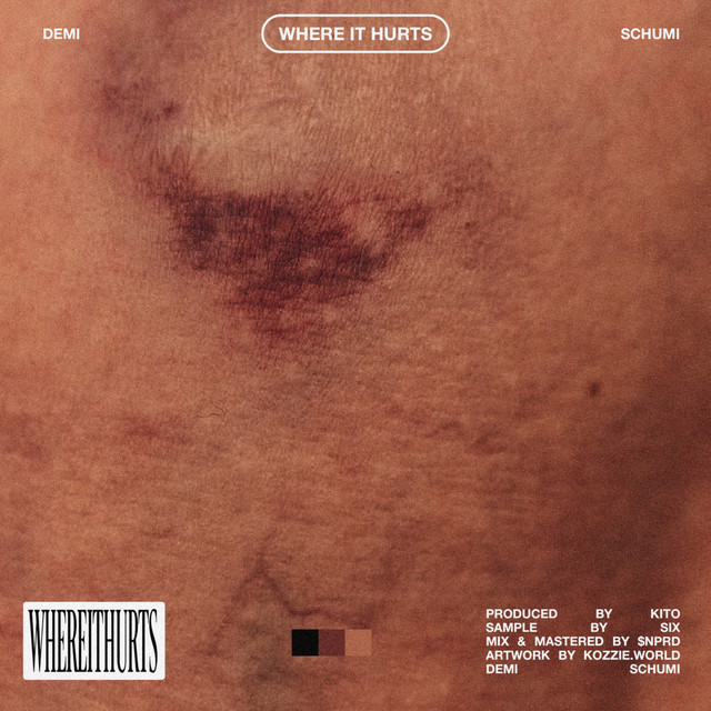 WHEREITHURTS (feat. Schumi) cover art