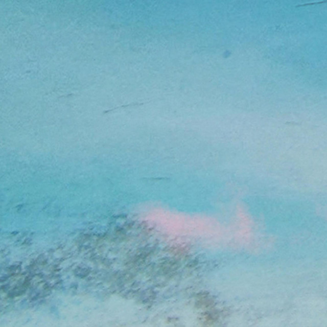 Miracle cover art
