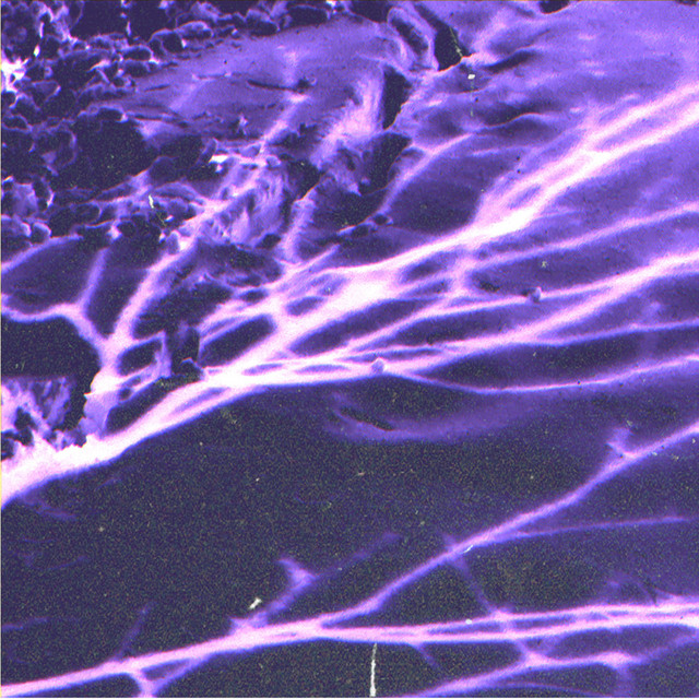 Post Winter cover art