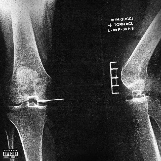 Torn Acl