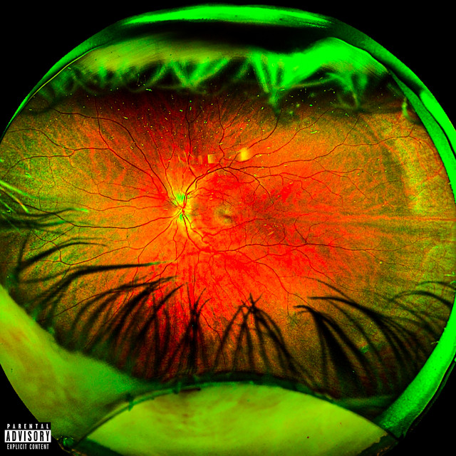 undefined album image