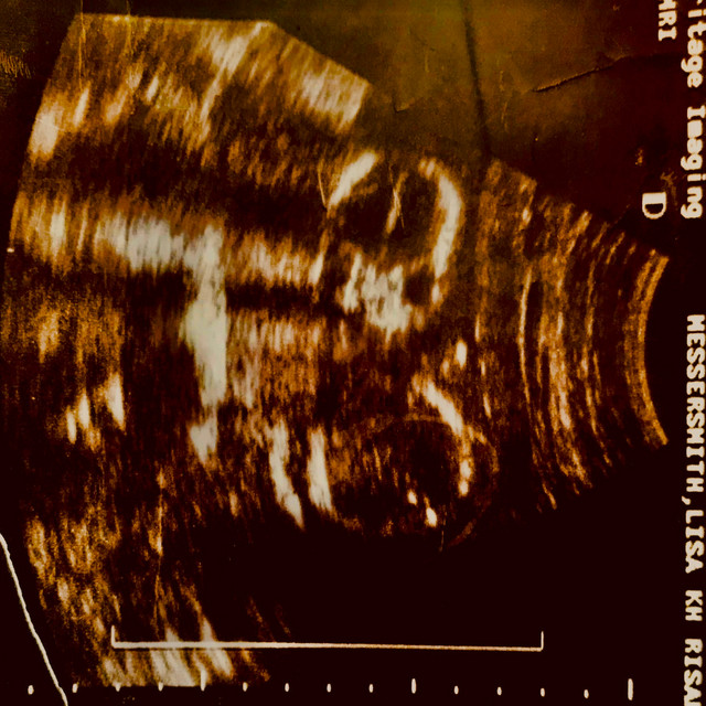 Demos cover art
