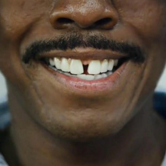 Gap Tooth cover