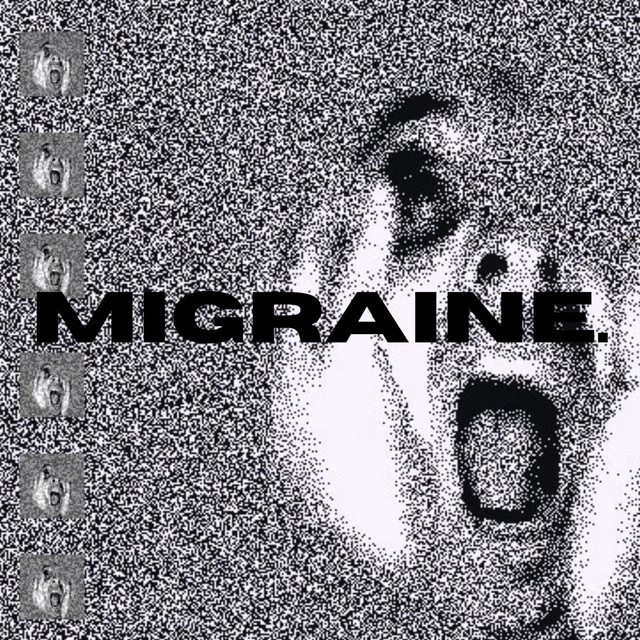 Migraine