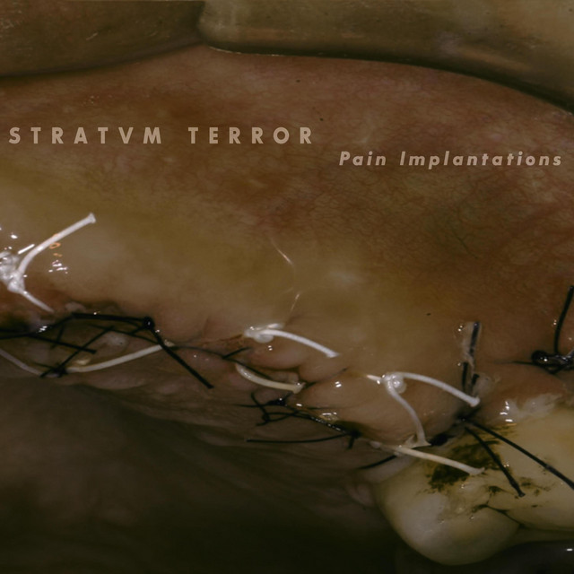Pain Implantations cover