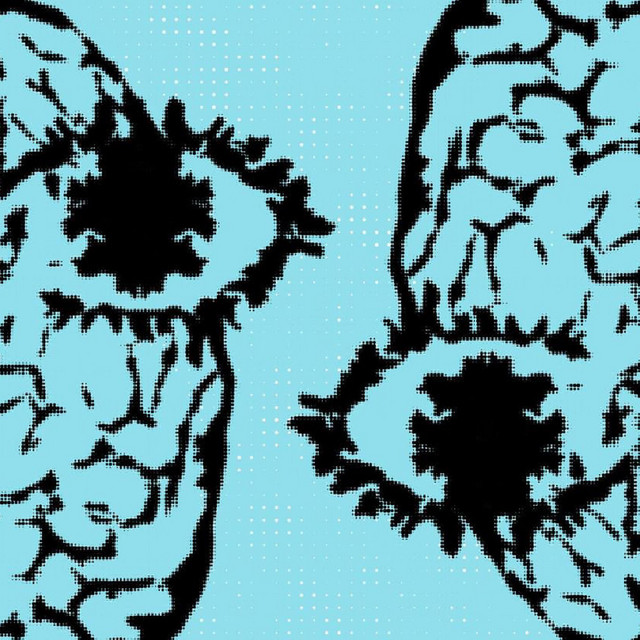 ready set go cover art