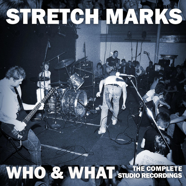 Stretch Marks Photo
