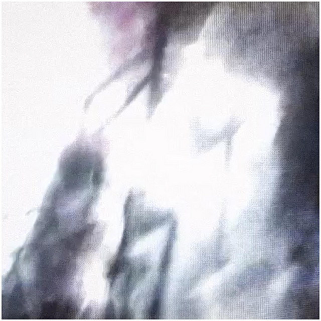 anything else cover art