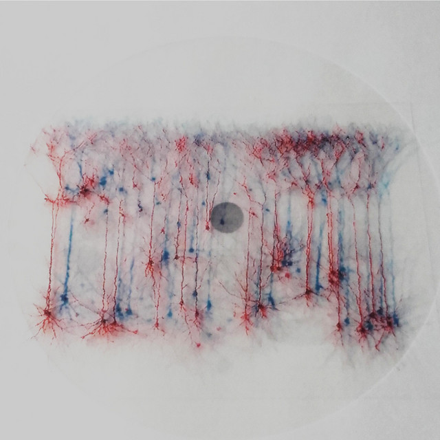 Severance (single)