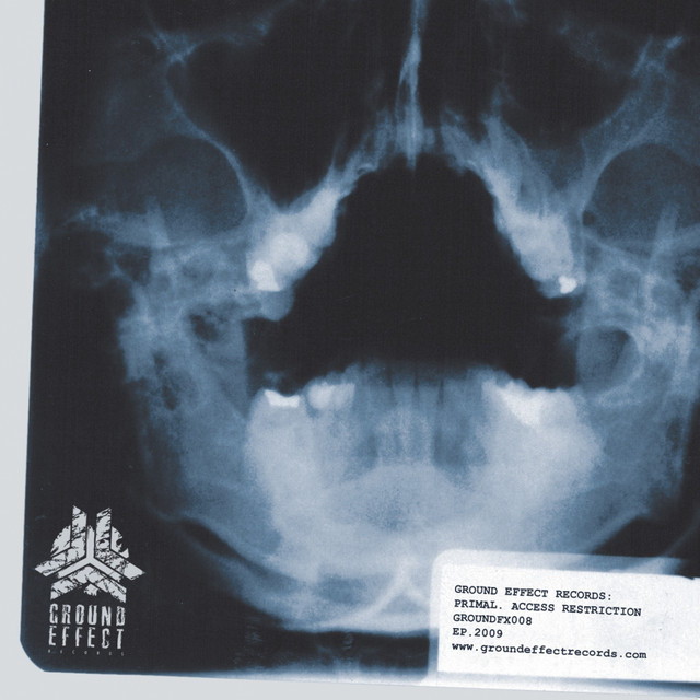 Access Restriction album art