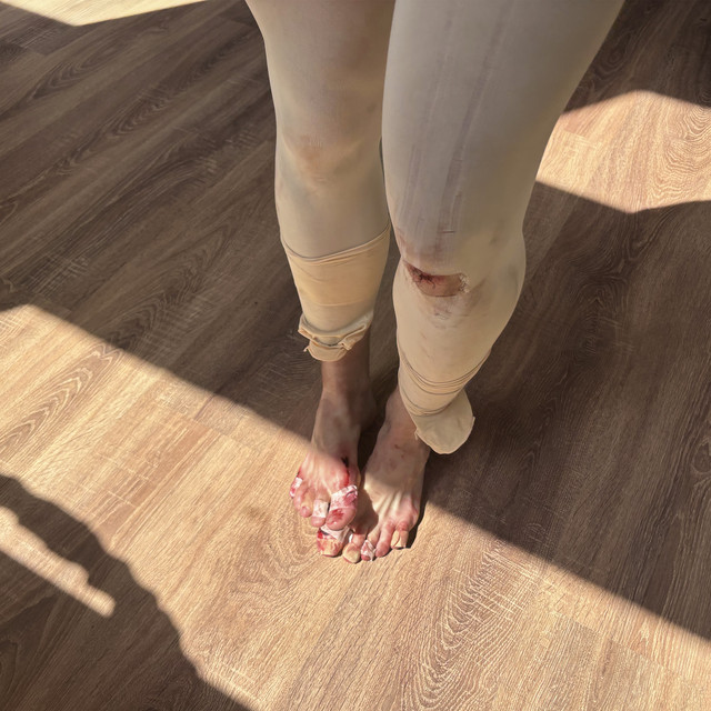 idk album image