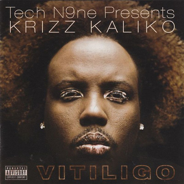 Vitiligo cover art