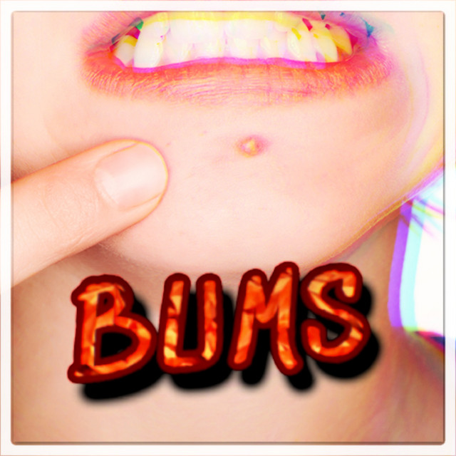 Bums