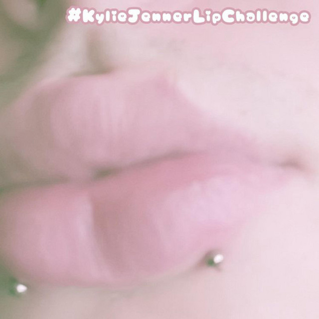 Kylie Jenner Lip Challenge cover art