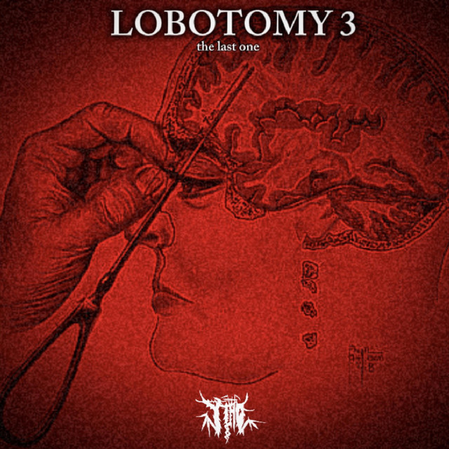LOBOTOMY 3 cover art