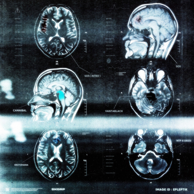 EPLEPTIK cover art