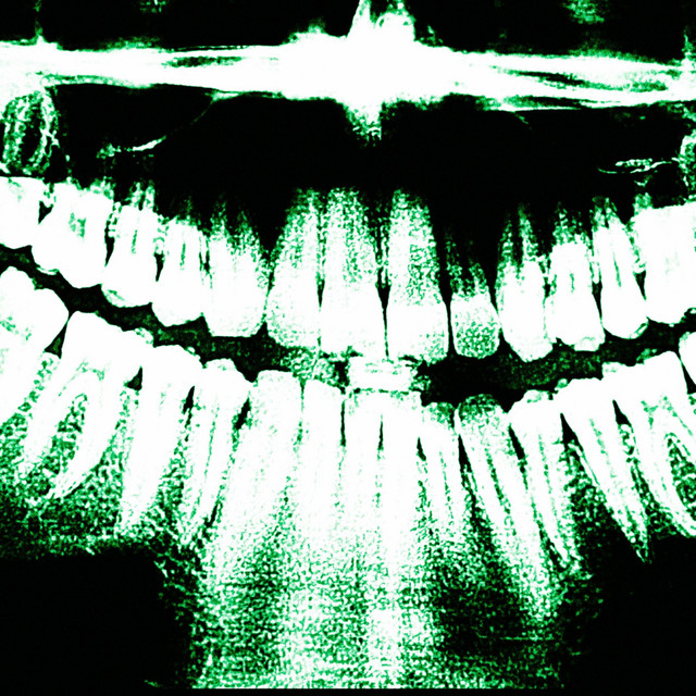 b4lom cover art