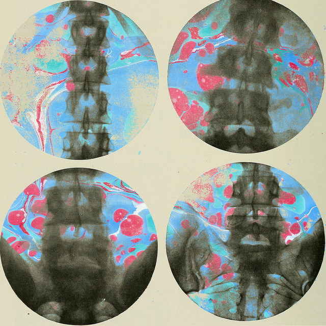 Backbone cover art