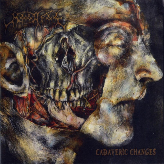Cadaveric changes cover