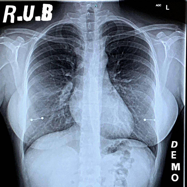 DEMO cover art