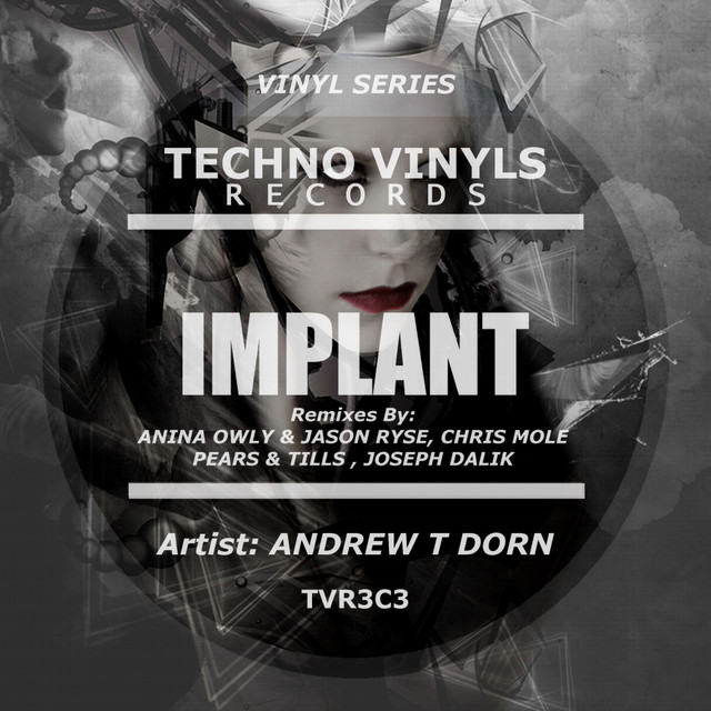 Implant - Chris Mole Remix cover art