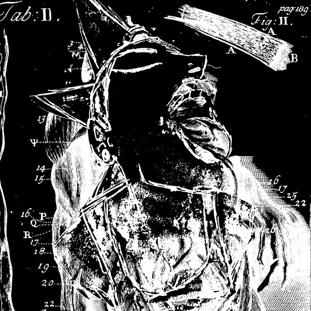 Splint cover art