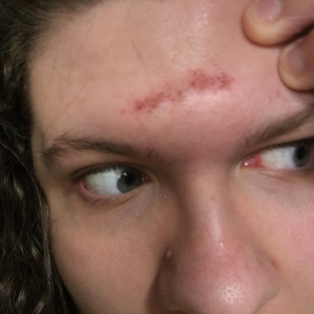 Third Eye Opening Scar cover art