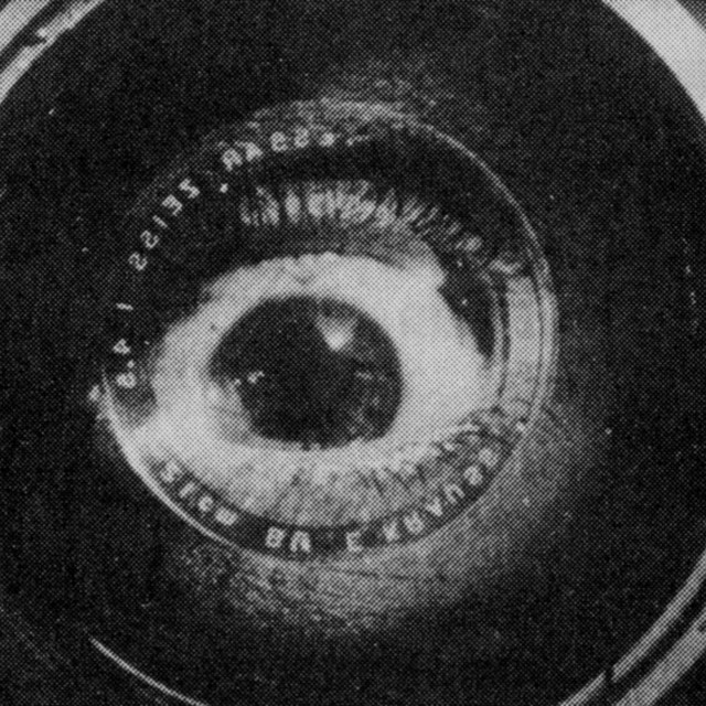 Eye Check