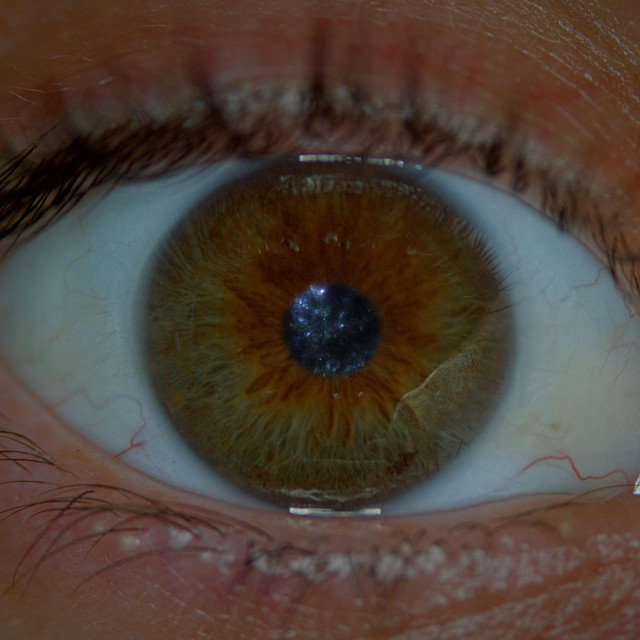 Staring Contest cover art