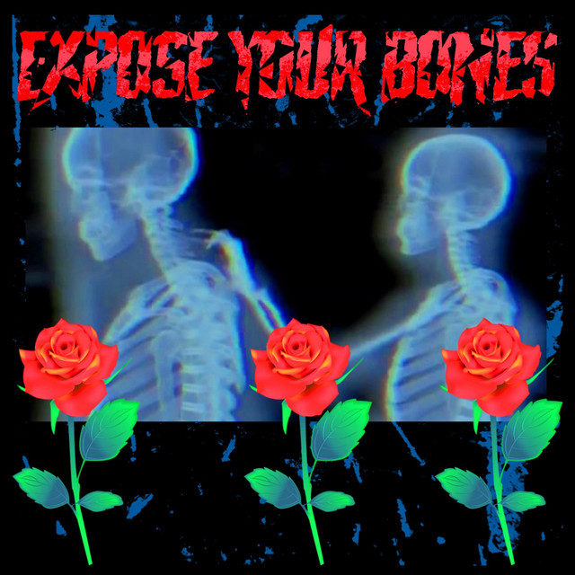 EXPOSE YOUR BONES cover art