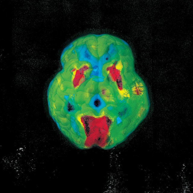 Brains cover art