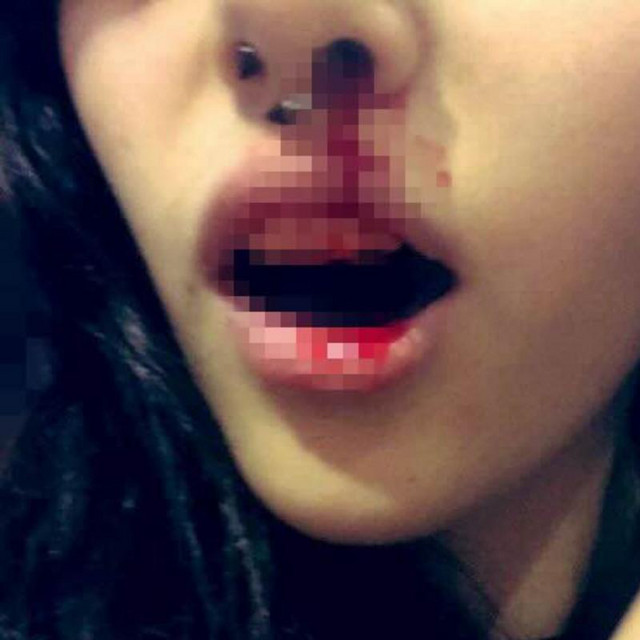 Vamp