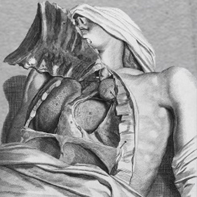 Hypothermiasma cover art