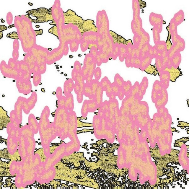الديون المستحقة cover art