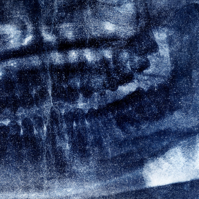Cover art: Кровотечі — Cruel blu