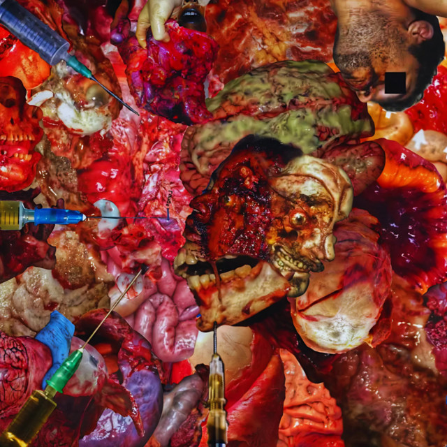 Full Forensic Gastric Bypass cover art
