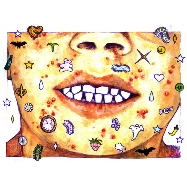 ACNÉ cover art