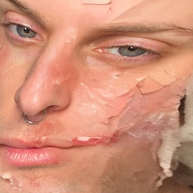 7 besos que me han rechazado estos meses cover art