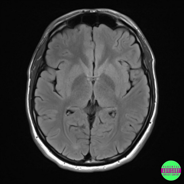 mindSET cover art