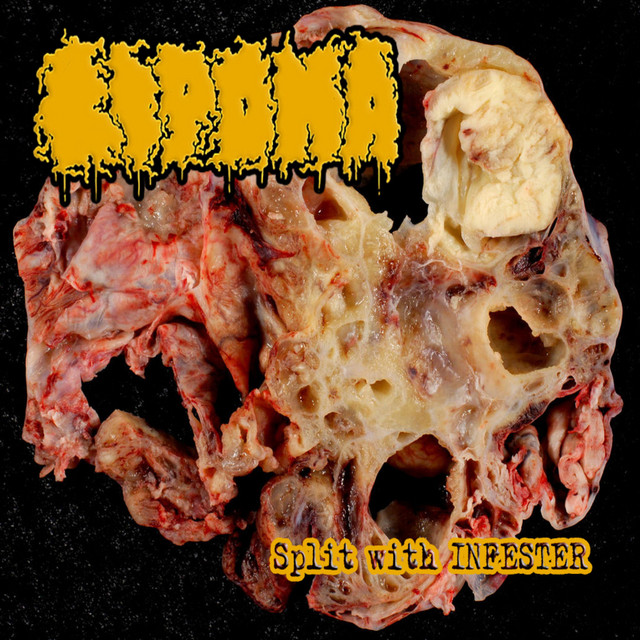 Split With Infester cover art